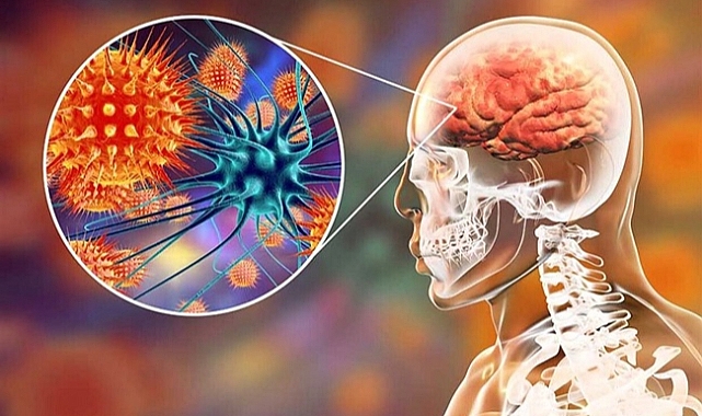 Menenjit Olguları Tekrar Görülmeye Başlandı Mı?